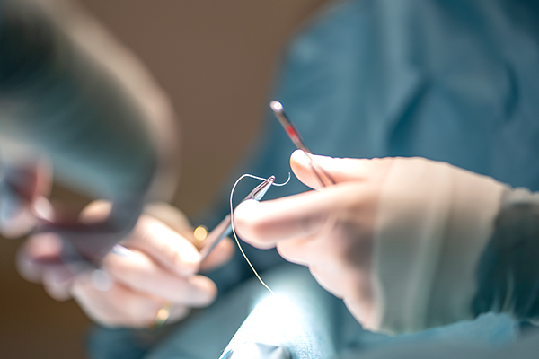 유방 혹 제거술